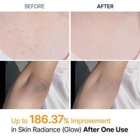 Dr. Melaxin Kojic Turmeric Body Peel