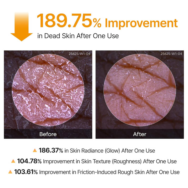 Dr. Melaxin Kojic Turmeric Body Peel